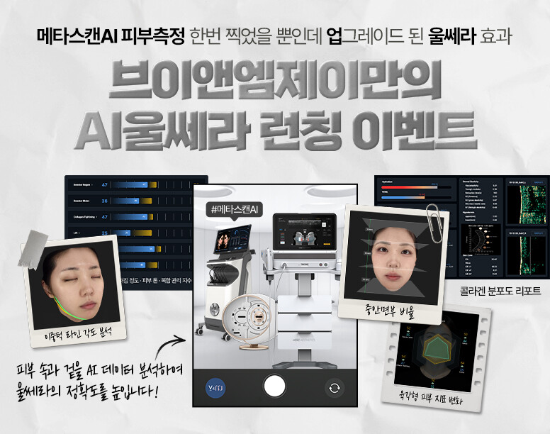 V&MJ피부과,울쎄라, 커스텀울쎄라, 울쎄라시술, 울쎄라전문, 울쎄라리프팅, 울쎄라리프팅시술