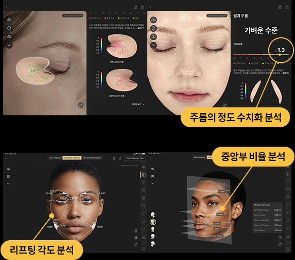 V&MJ 브이앤엠제이 AI 육각형 피부 진단