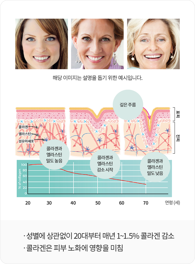 
				성별에 상관없이 20대부터 매년 1~1.5% 콜라겐 감소
				콜라겐은 피부 노화에 영향을 미침
				
