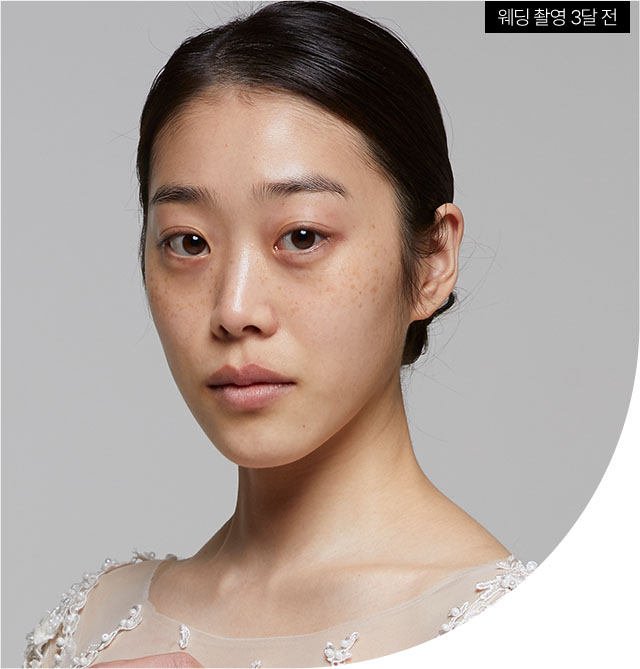 리프팅,리프팅케어,안티에이징,피부탄력,피부탄력관리,피부과리프팅,주름살,주름시술,피부관리,피부샵,피부관리실,탄력,이마주름,팔자주름,팔자주름시술,팔자주름없애기