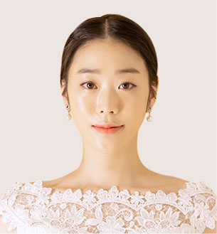 신부케어,예비신부피부관리,웨딩준비,예비신부관리,웨딩피부,웨딩에스테틱,신부다이어트,예비신부다이어트,예신다이어트,슬리밍관리,예신다이어트가격,경락,웨딩스킨케어,신랑관리