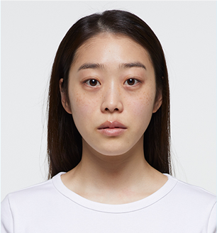 신부케어,예비신부피부관리,웨딩준비,예비신부관리,웨딩피부,웨딩에스테틱,신부다이어트,예비신부다이어트,예신다이어트,슬리밍관리,예신다이어트가격,경락,웨딩스킨케어,신랑관리