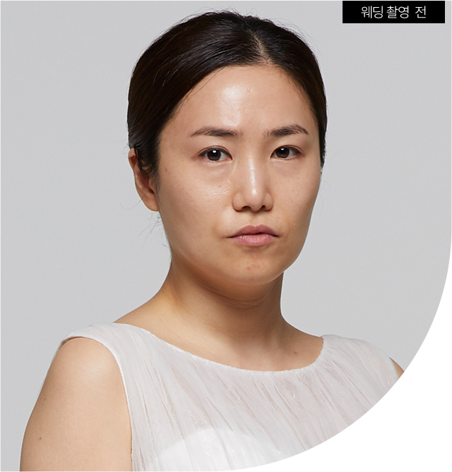 리프팅,리프팅케어,안티에이징,피부탄력,피부탄력관리,피부과리프팅,주름살,주름시술,피부관리,피부샵,피부관리실,탄력,이마주름,팔자주름,팔자주름시술,팔자주름없애기